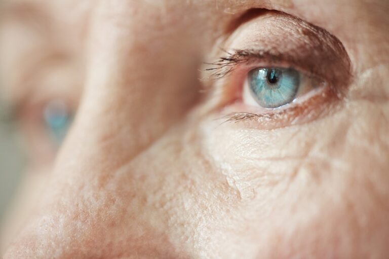 what are cataracts