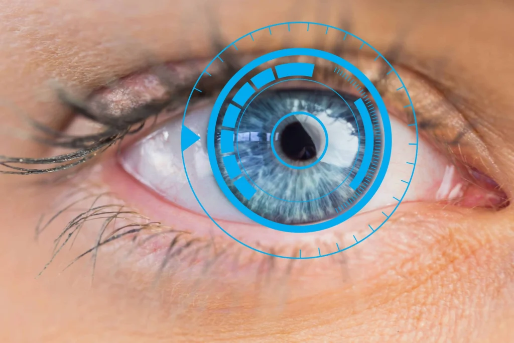 LASIK eye surgery terms