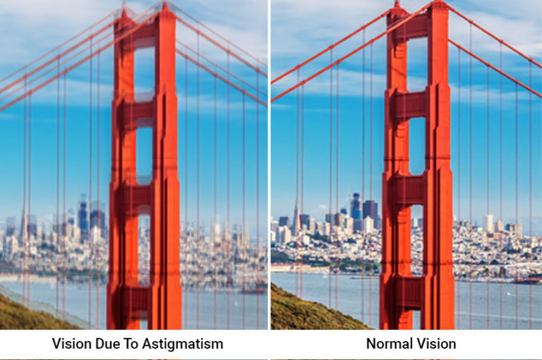astigmatism-vision