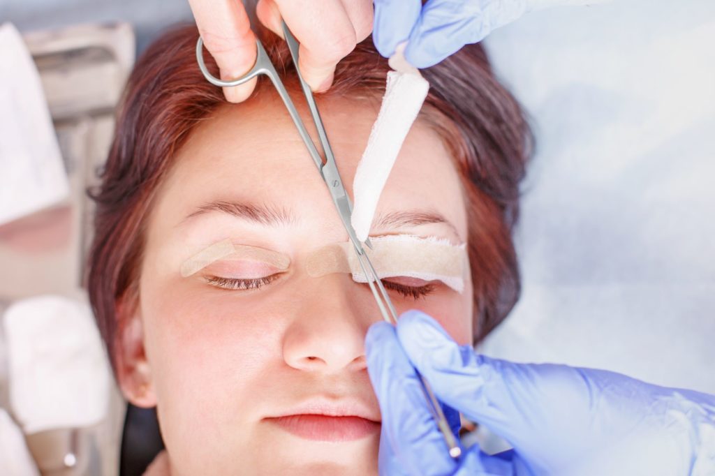 Blepharoplasty surgery