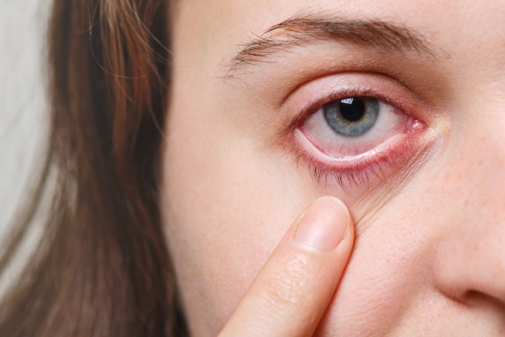 Retinal tear eye