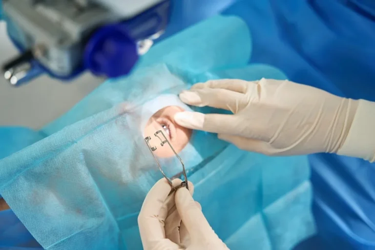 Catarct-Eye-Surgery-Twice